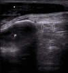 Fig. 14.