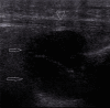 Fig. 18.