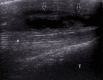 Fig. 16.