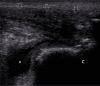 Fig. 20.