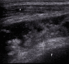 Fig. 10.