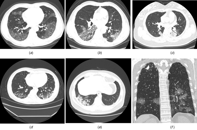 Fig. 2.