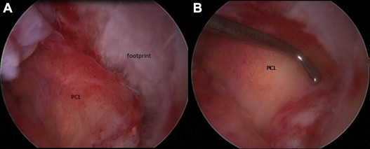 Fig 5