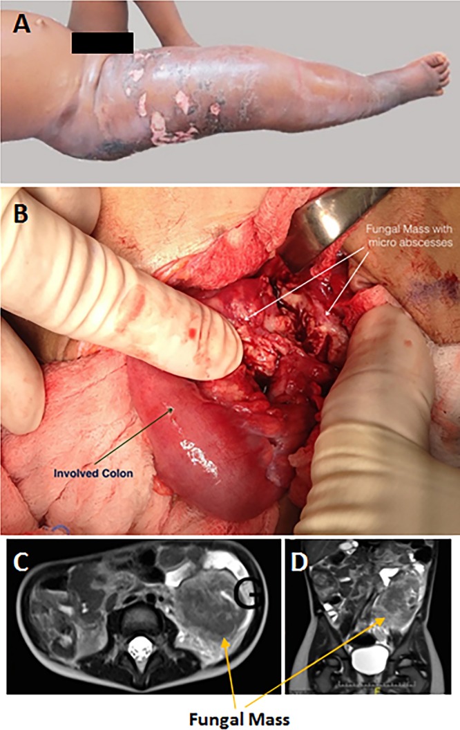 FIG 12