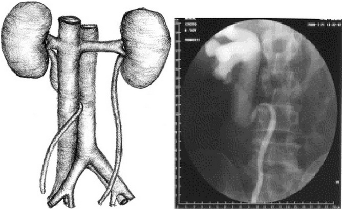 Fig. 13