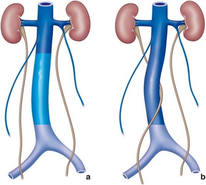 Fig. 12