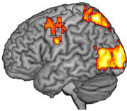 graphic file with name brainsci-13-00069-i003.jpg