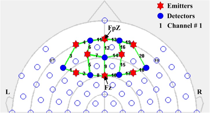 FIGURE 2