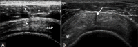 Figure 12 (A, B)