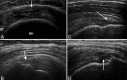 Figure 11 (A-D)