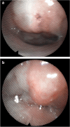 Fig. 2