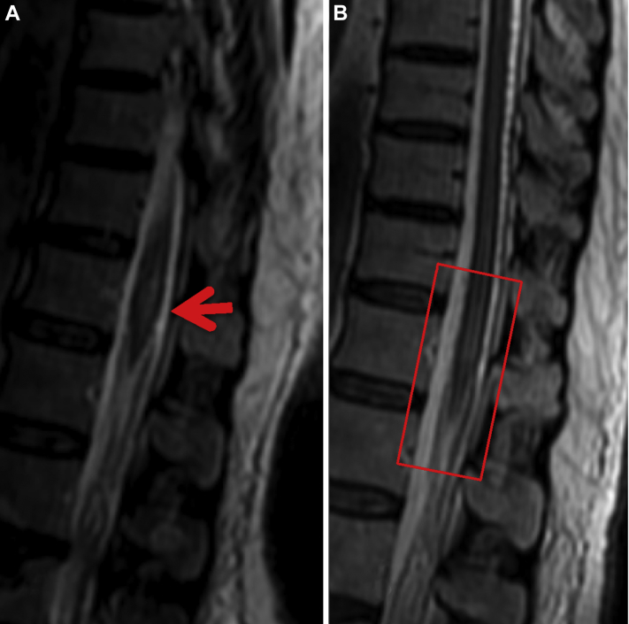 Fig. 3