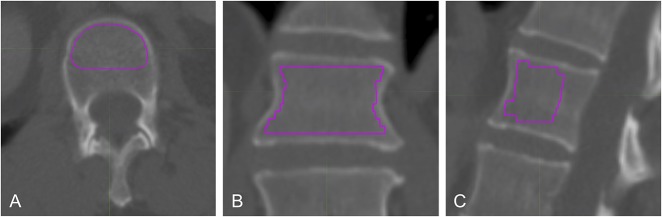 Fig. 1A-C