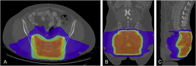 Fig. 2 A-C