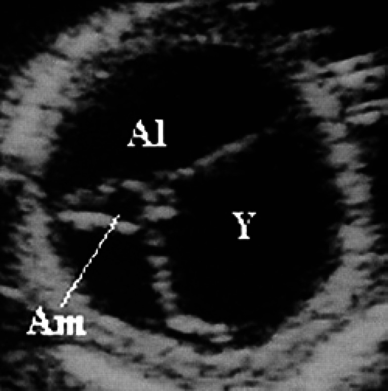 Fig 32.