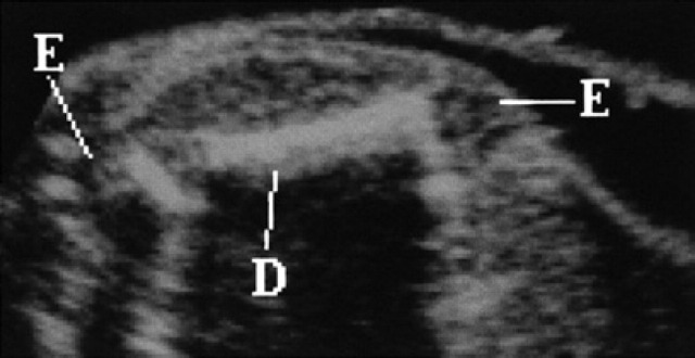 Fig 21.