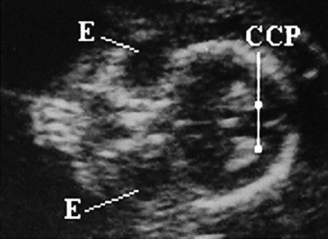 Fig 22.