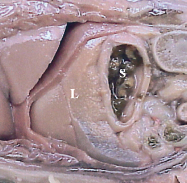 Fig 28.