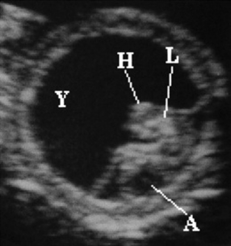 Fig 11.