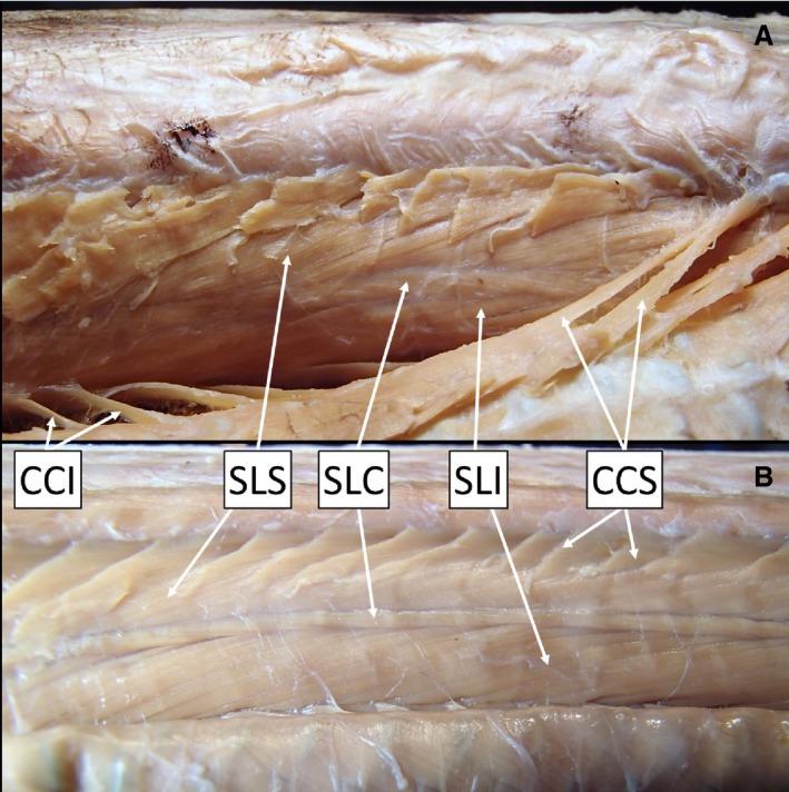 Quantitative axial myology in two constricting snakes: Lampropeltis ...