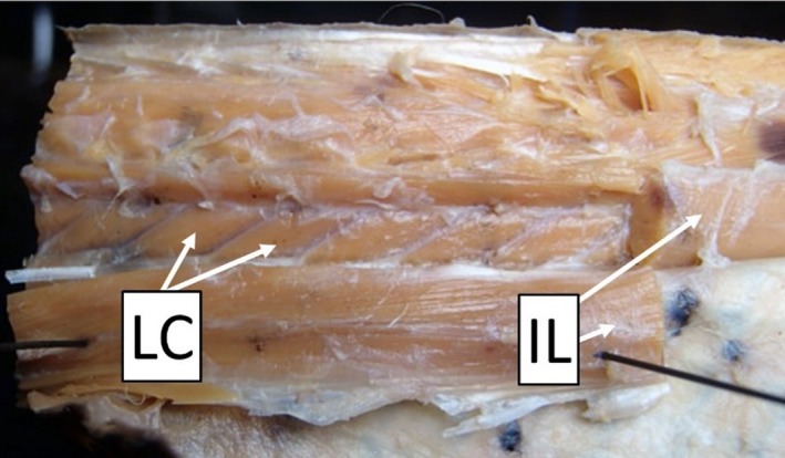 Quantitative axial myology in two constricting snakes: Lampropeltis ...