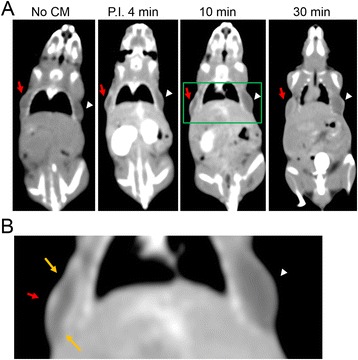 Fig. 10