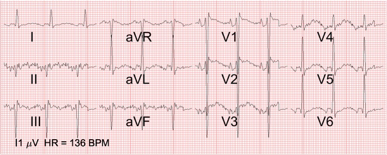 Fig 6