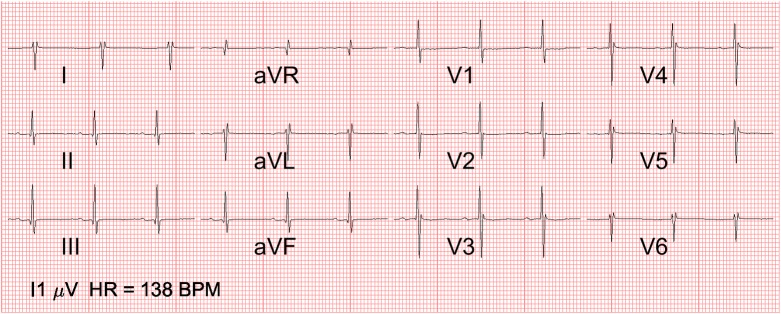 Fig 5