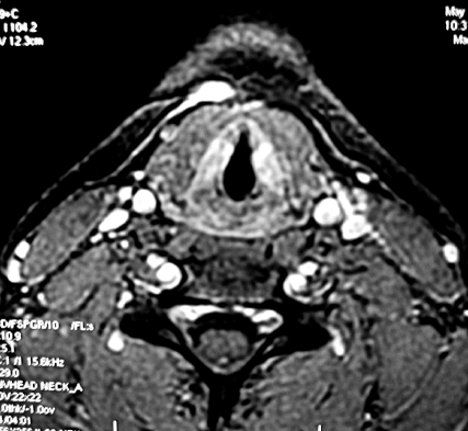 Fig. 1b