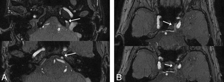 Fig 3.