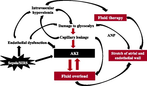 Fluid overload and acute kidney injury: cause or consequence? - PMC