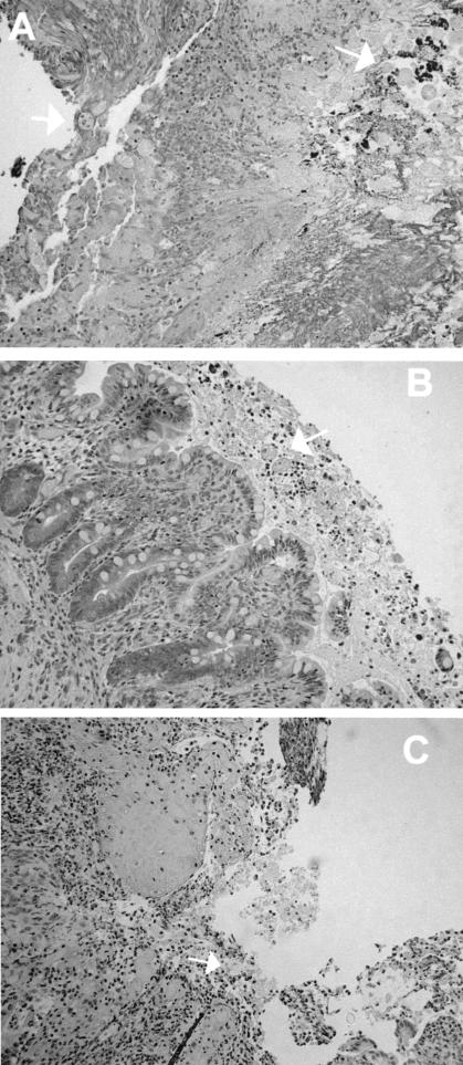 FIG. 2.