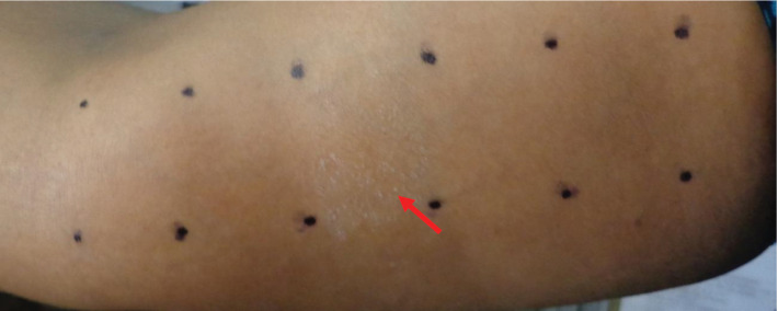 FIGURE 1.