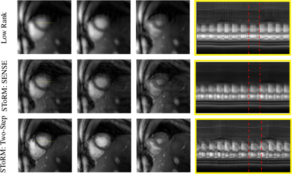 Fig. 4: