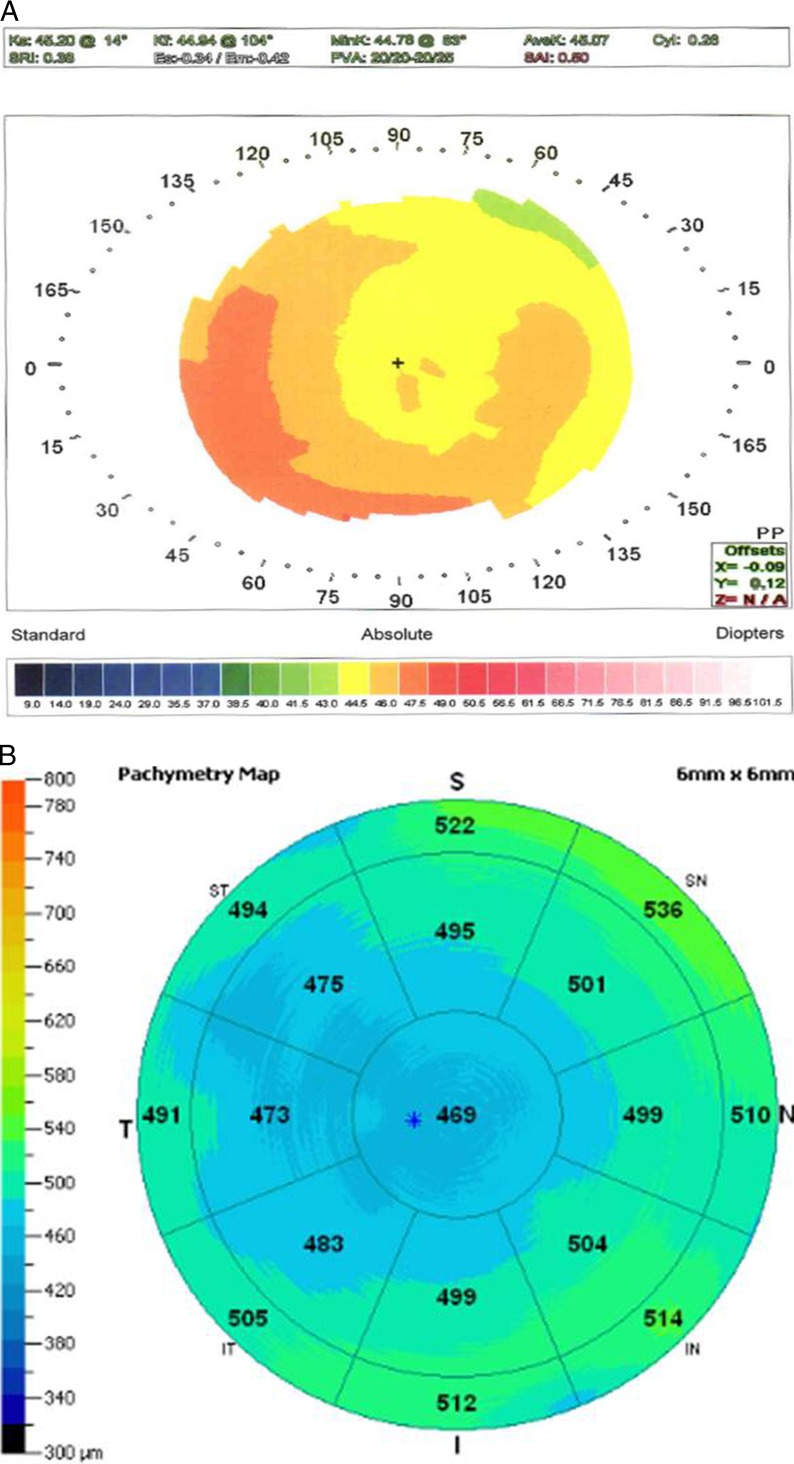 Figure 4