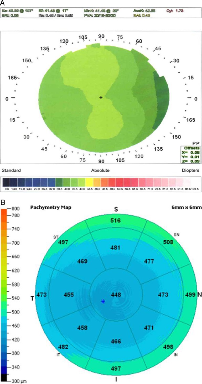 Figure 3. 