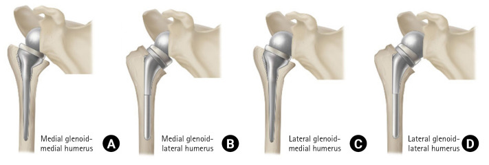 Fig. 10.