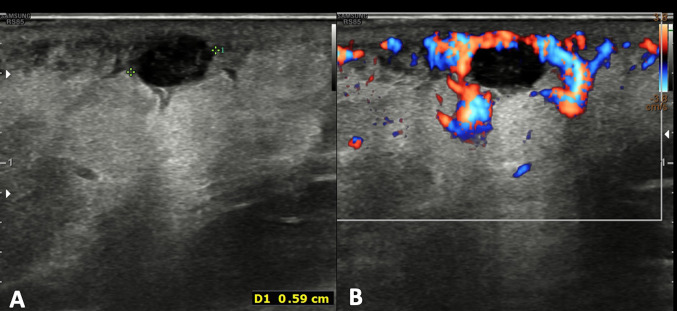 Fig. 6