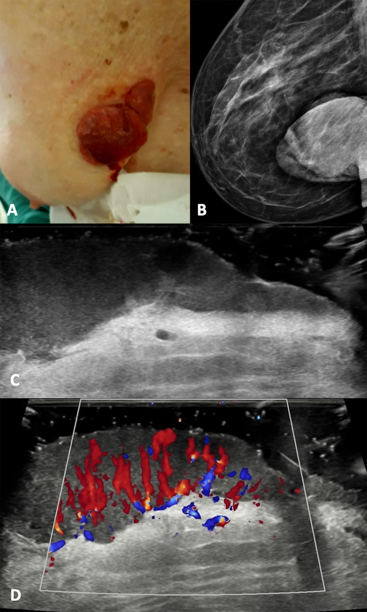 Fig. 4