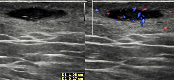 Fig. 8