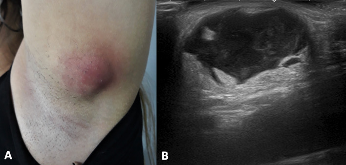 Fig. 14