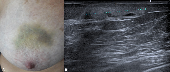 Fig. 10