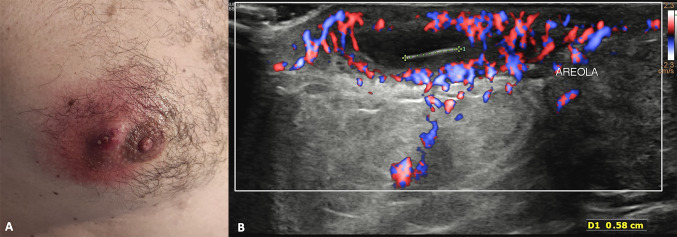 Fig. 11