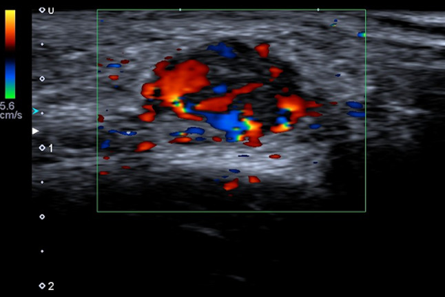 Fig. 9