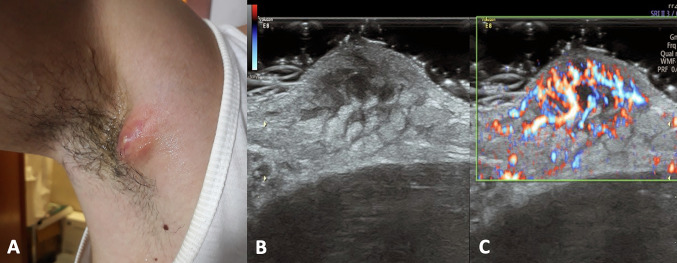 Fig. 13