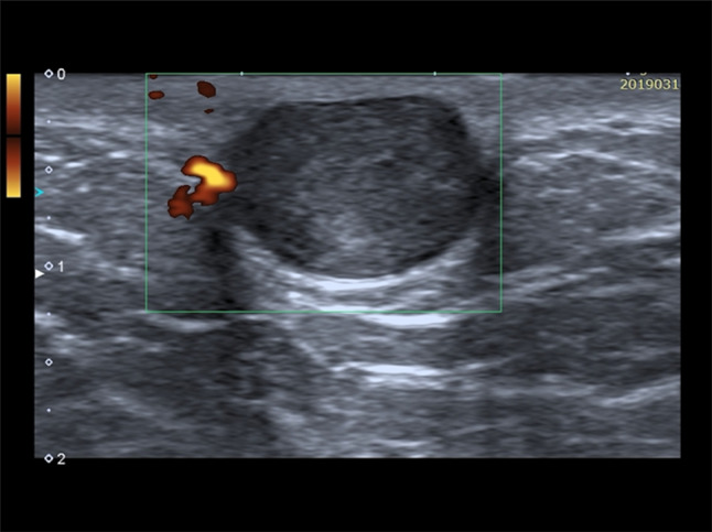 Fig. 5