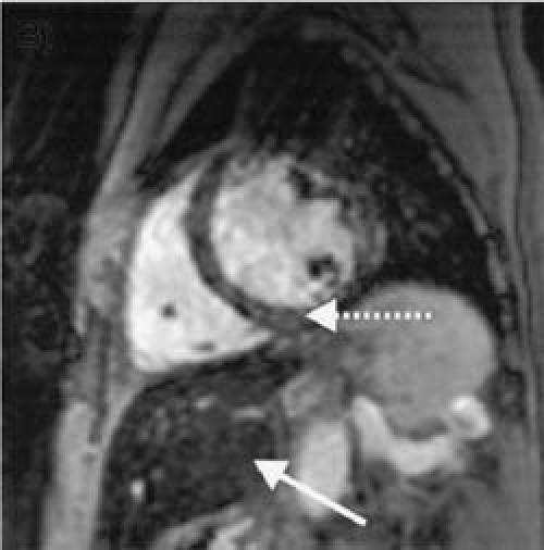 graphic file with name 45FF2.jpg