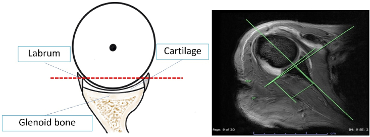 Fig. 3
