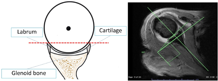 Fig. 4