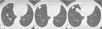 Fig 2 –
